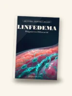 Linfedema — Diagnóstico Diferencial - Imagem 2