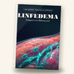 Linfedema — Diagnóstico Diferencial