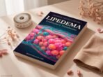 Manual de Lipedema — livro